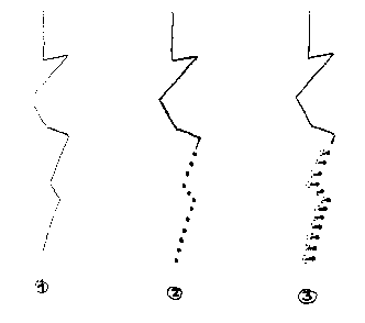 Skizze Perlschnurblitz